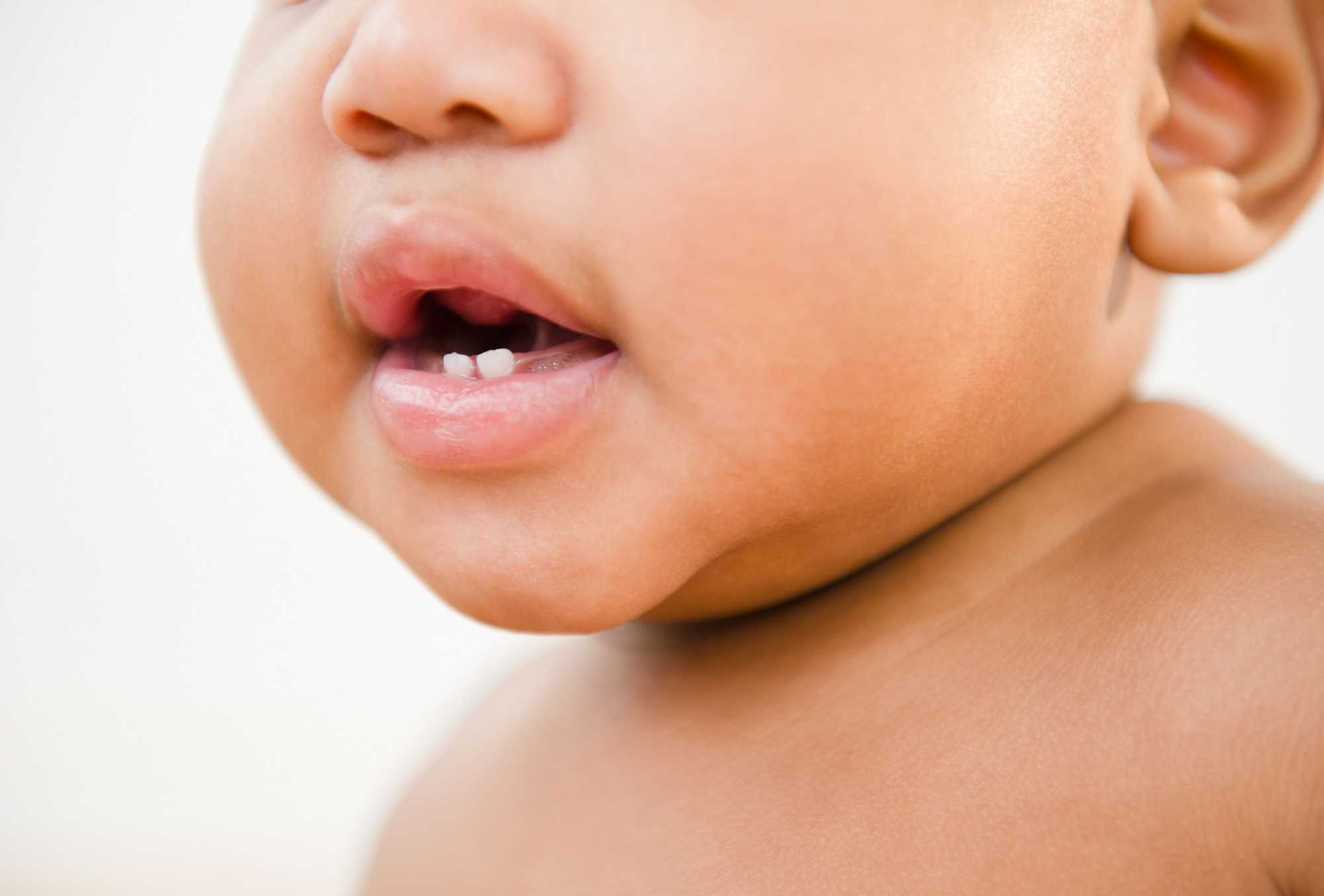 Ako upokojiť dieťa s bolesťami pri raste zubov